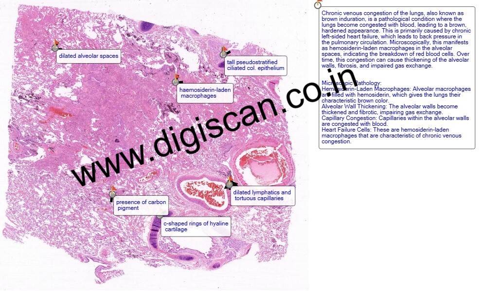 Pathology Digital Slides Set (Basic Pathology & Pathological Processes)
